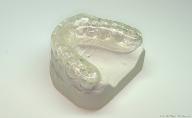 Knirscherschiene: Verhindert das nächtliche Zähneknirschen